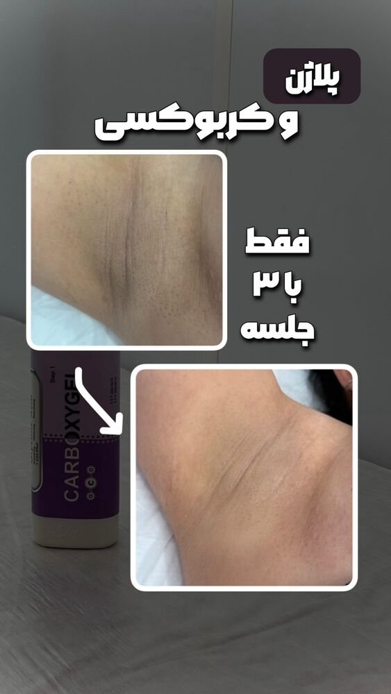  جدید ترین استوری اینستاگرام الناز شمی