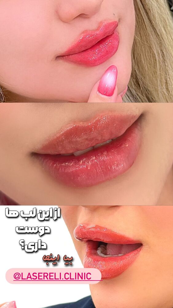  جدید ترین استوری اینستاگرام الناز شمی