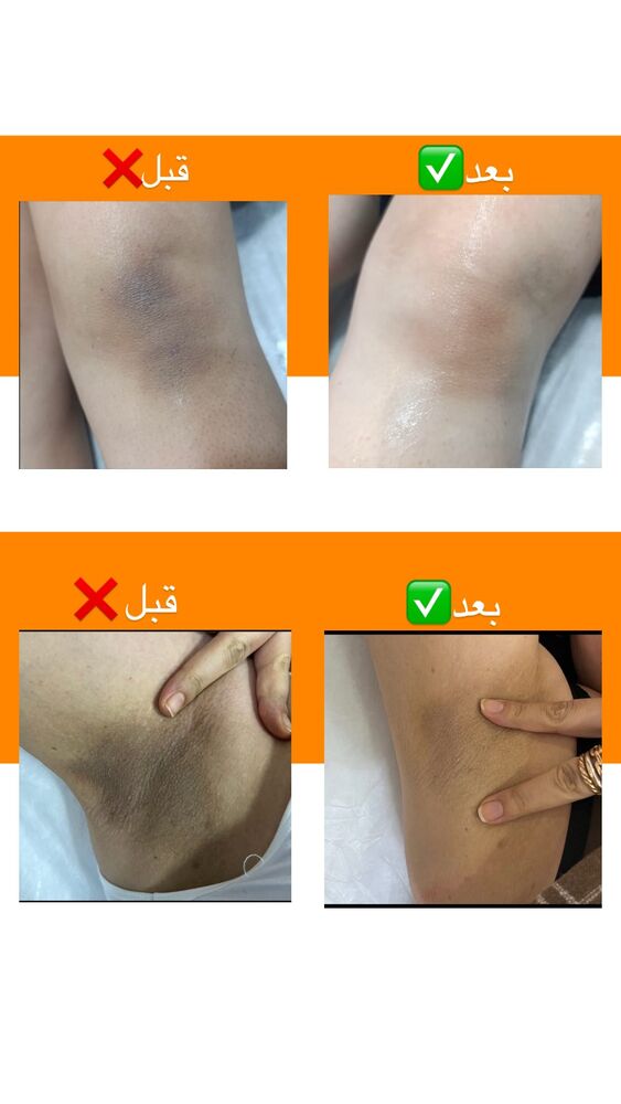  جدید ترین استوری اینستاگرام الناز شمی