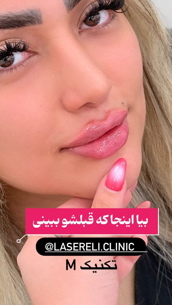  جدید ترین استوری اینستاگرام الناز شمی
