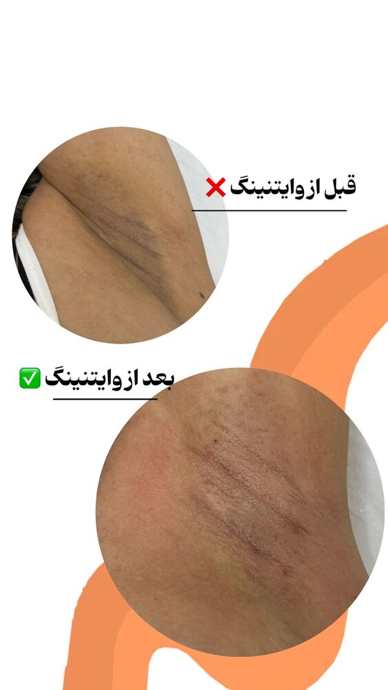  جدید ترین استوری اینستاگرام الناز شمی