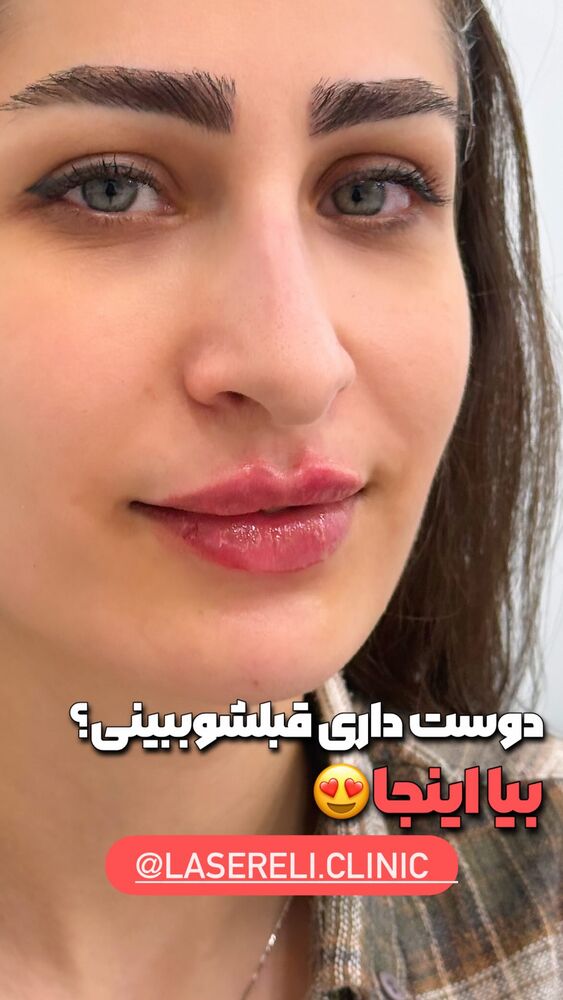  جدید ترین استوری اینستاگرام الناز شمی