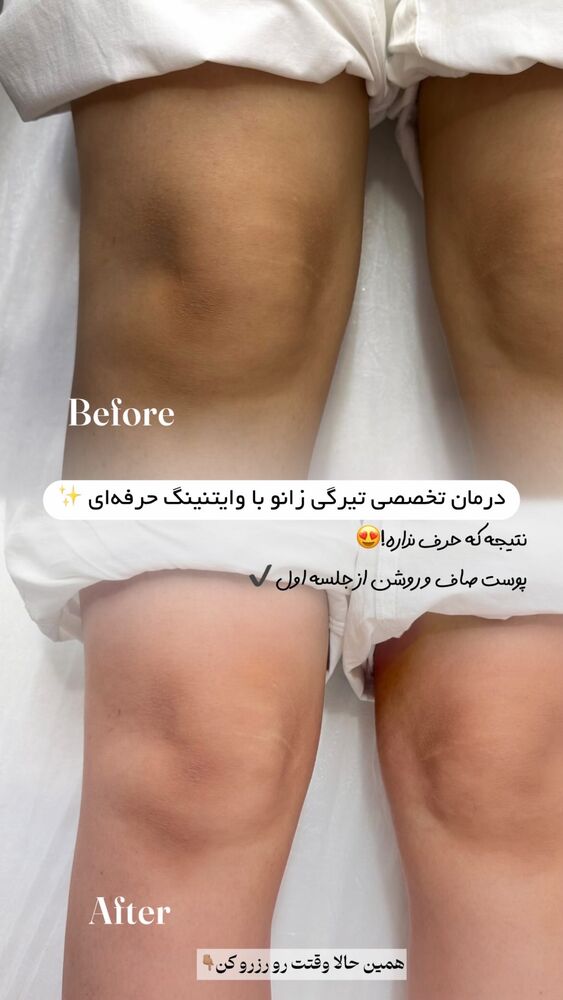  جدید ترین استوری اینستاگرام الناز شمی