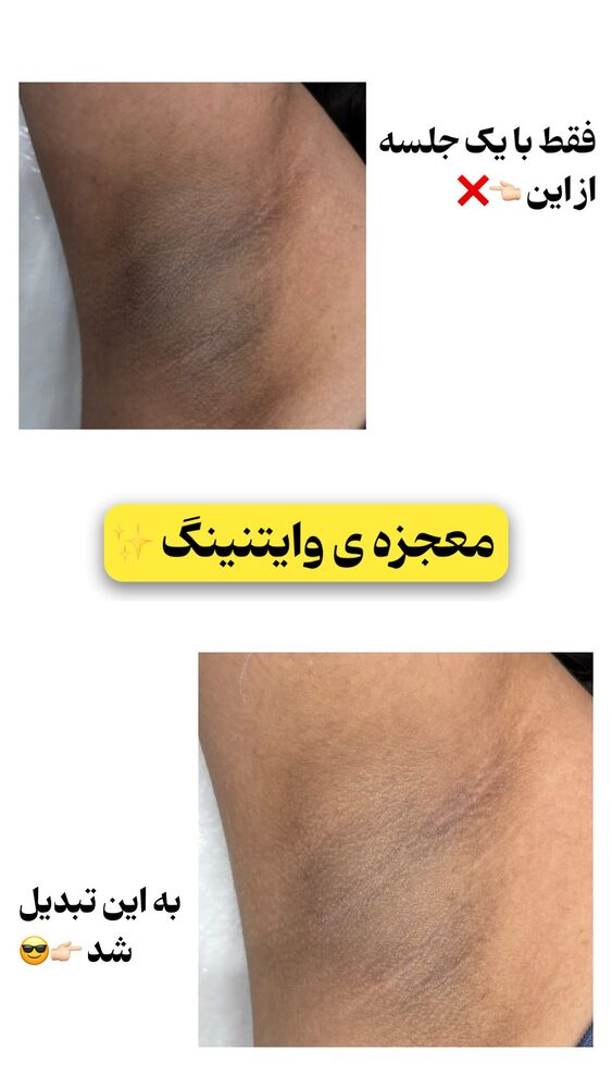  جدید ترین استوری اینستاگرام الناز شمی