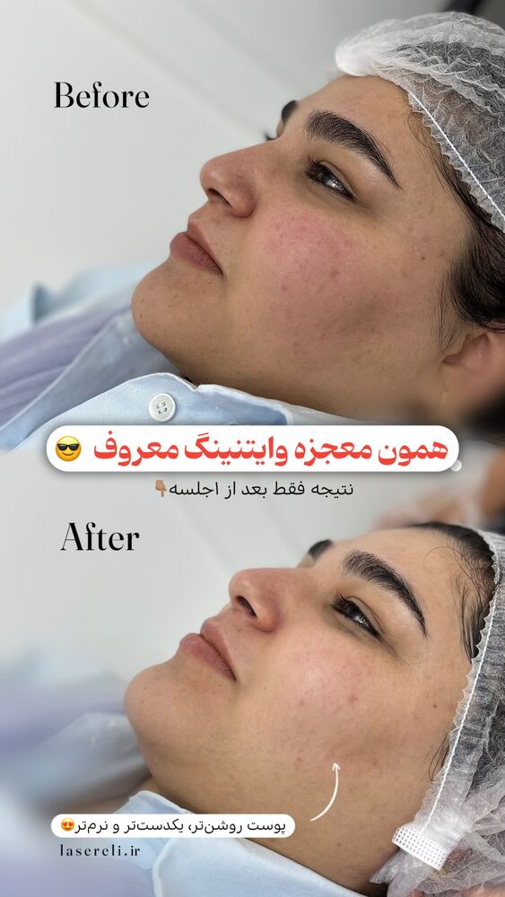  جدید ترین استوری اینستاگرام الناز شمی