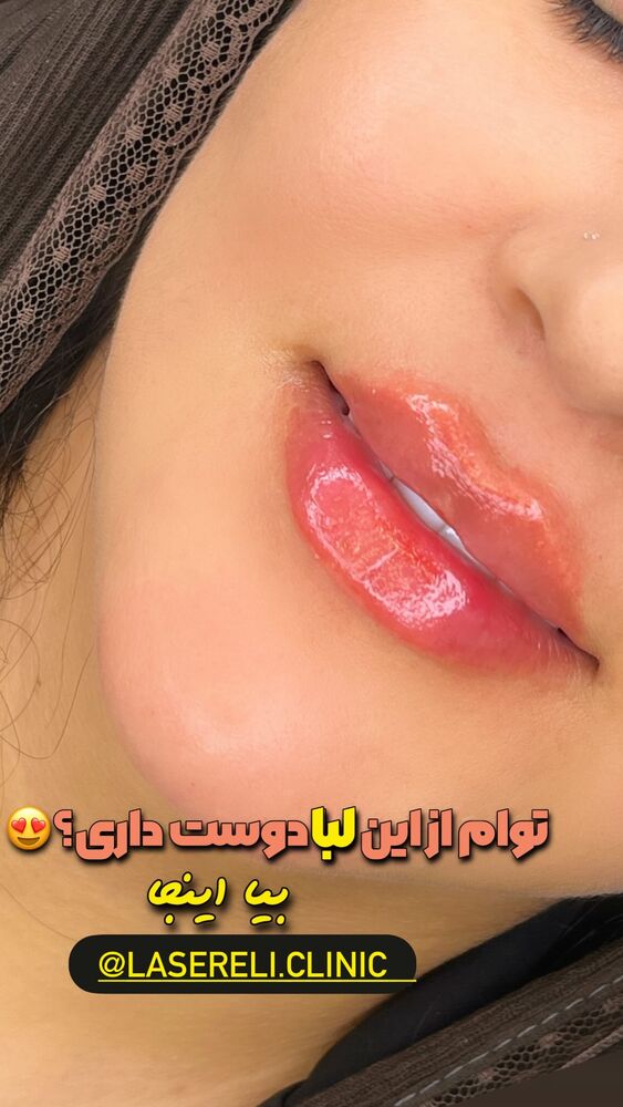  جدید ترین استوری اینستاگرام الناز شمی