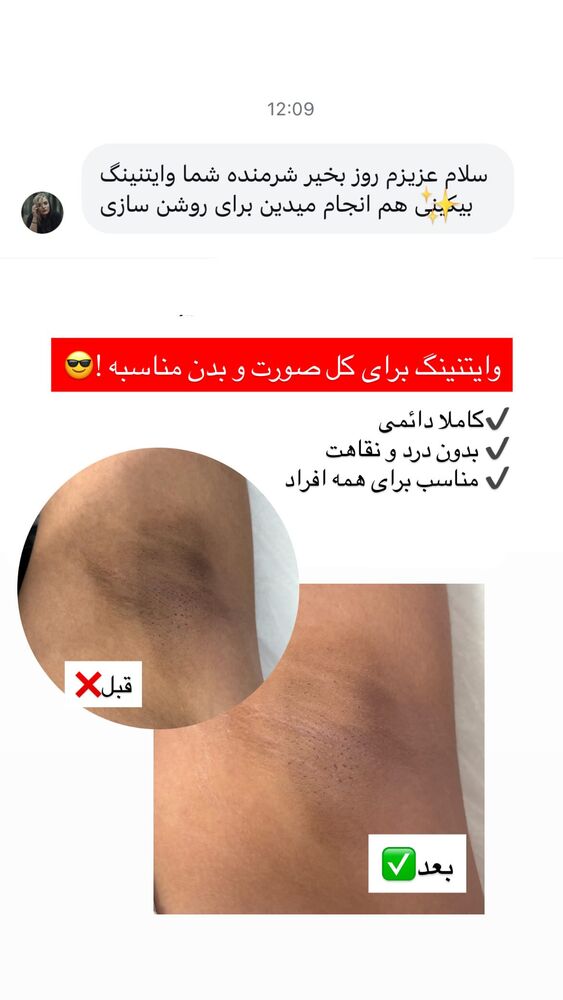  جدید ترین استوری اینستاگرام الناز شمی