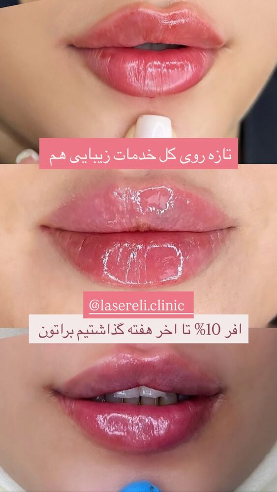  جدید ترین استوری اینستاگرام الناز شمی
