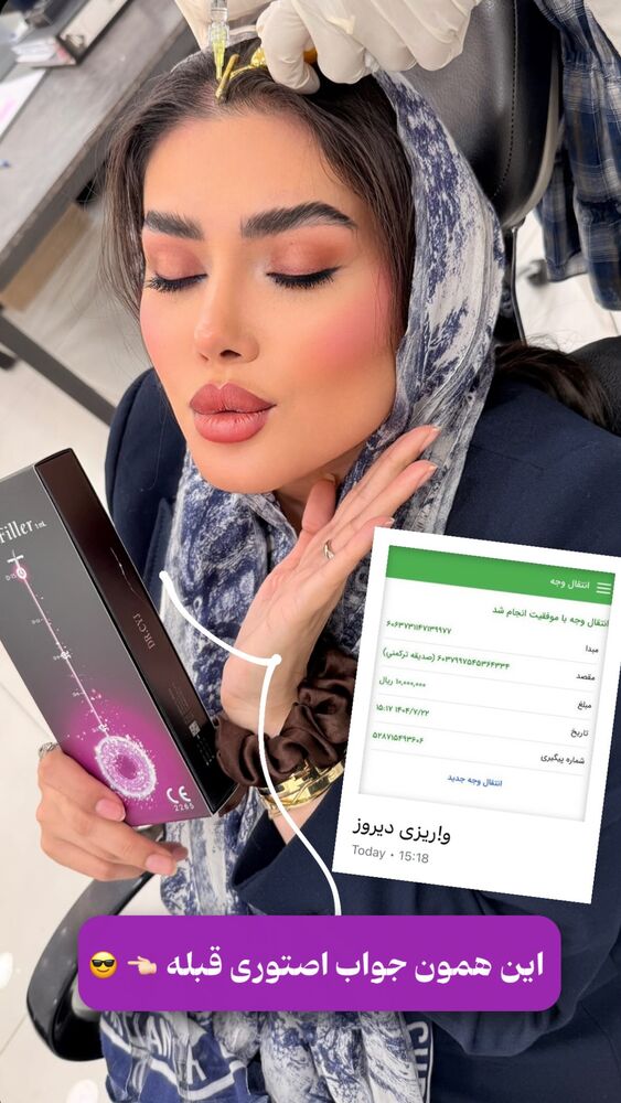  جدید ترین استوری اینستاگرام الناز شمی