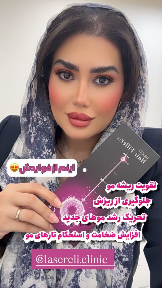  جدید ترین استوری اینستاگرام الناز شمی