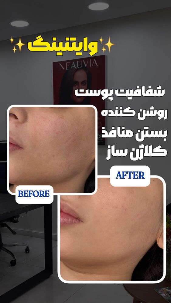  جدید ترین استوری اینستاگرام الناز شمی