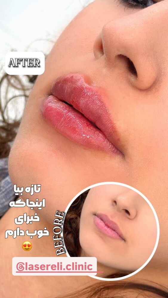  جدید ترین استوری اینستاگرام الناز شمی