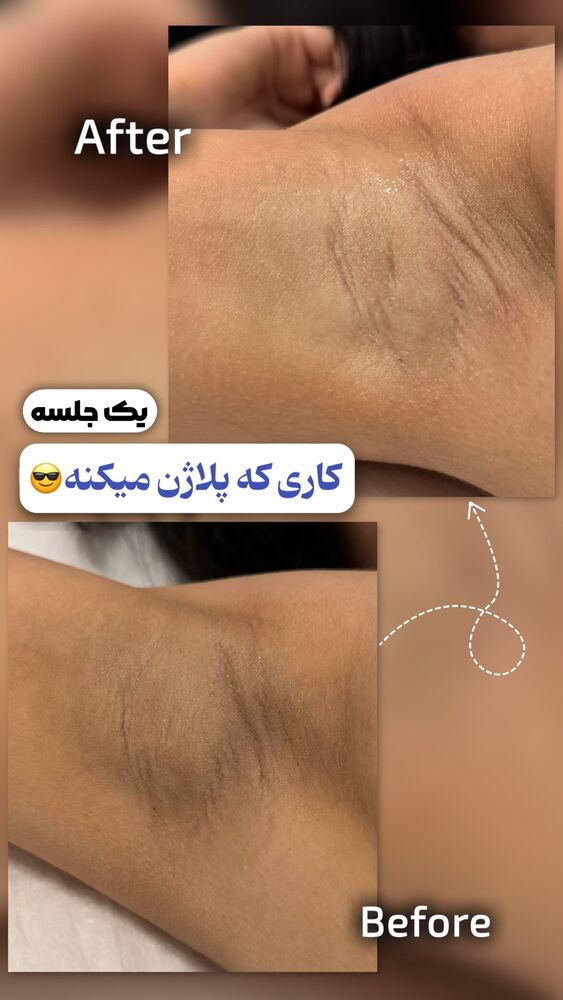  جدید ترین استوری اینستاگرام الناز شمی