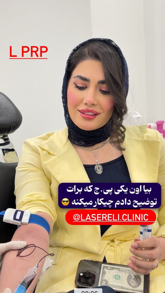  جدید ترین استوری اینستاگرام الناز شمی