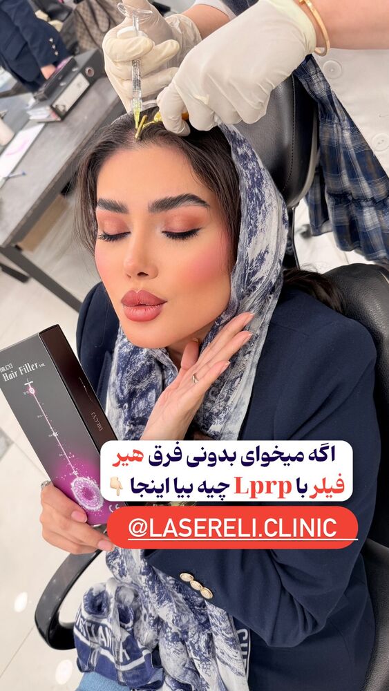  جدید ترین استوری اینستاگرام الناز شمی