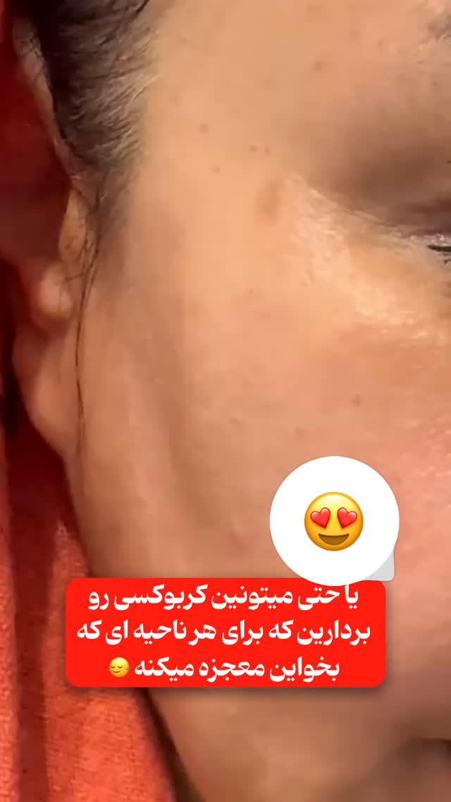 جدید ترین استوری اینستاگرام الناز شمی