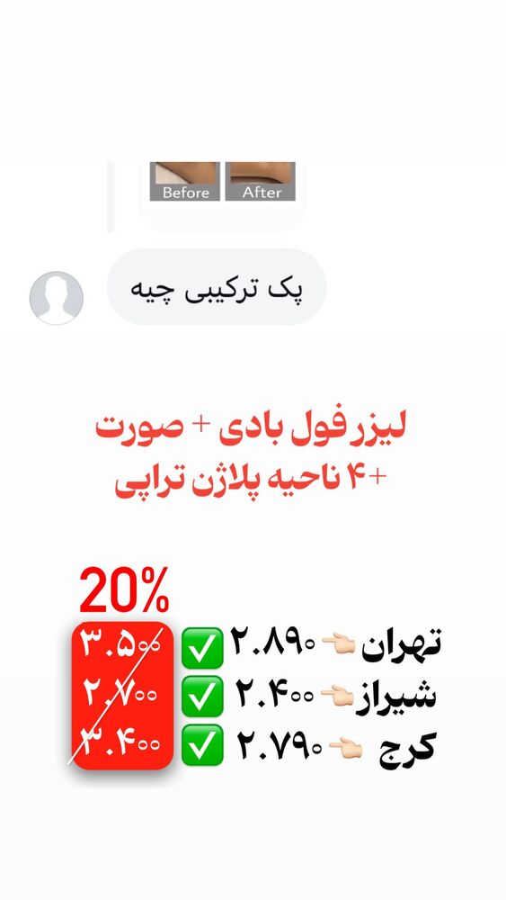  جدید ترین استوری اینستاگرام الناز شمی