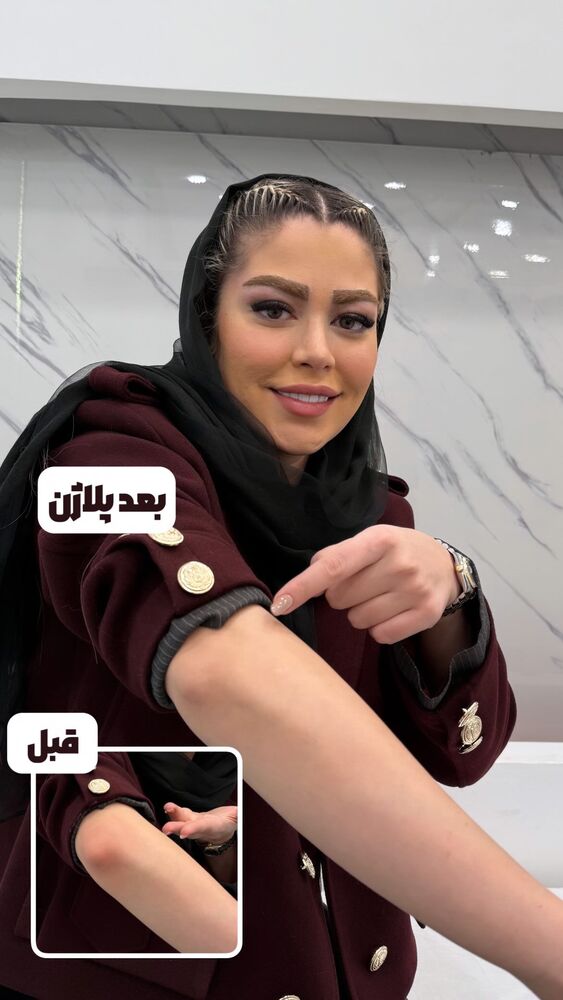  جدید ترین استوری اینستاگرام الناز شمی