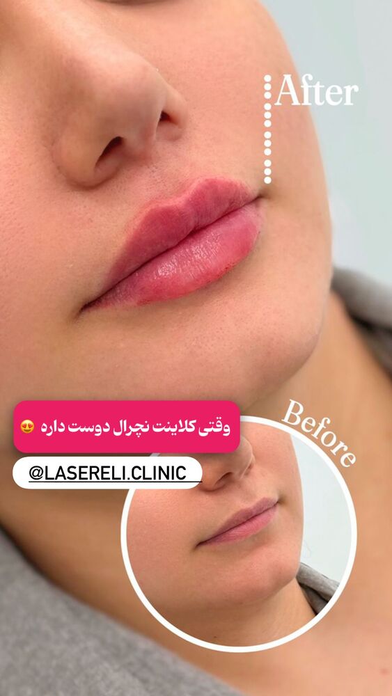  جدید ترین استوری اینستاگرام الناز شمی
