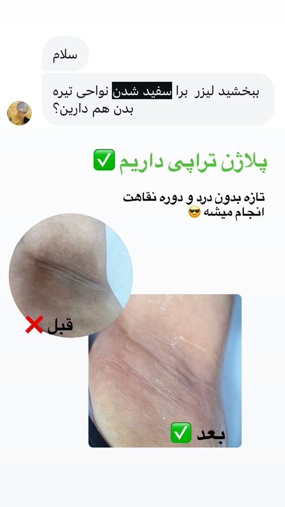  جدید ترین استوری اینستاگرام الناز شمی