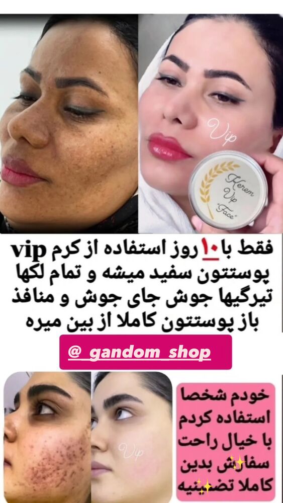  جدید ترین استوری اینستاگرام مائده کریمی
