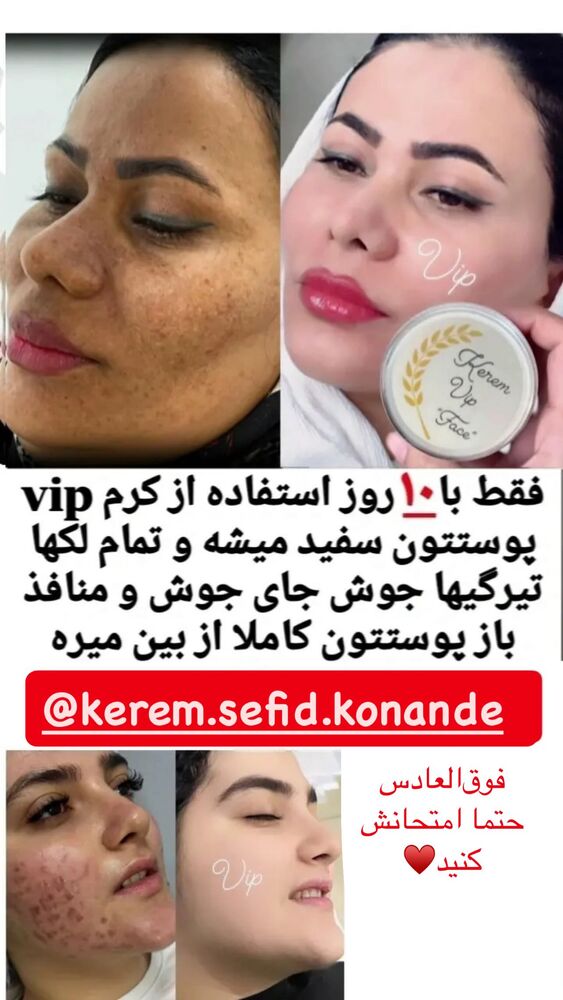  جدید ترین استوری اینستاگرام مائده کریمی