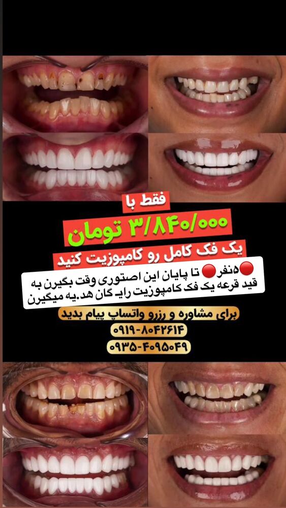 جدید ترین استوری اینستاگرام مائده کریمی