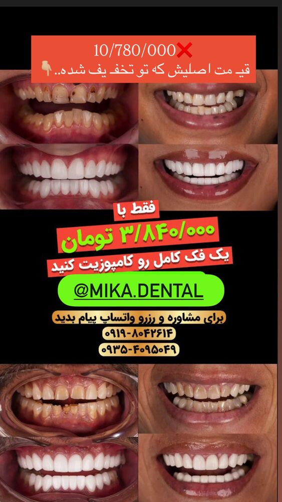  جدید ترین استوری اینستاگرام مائده کریمی