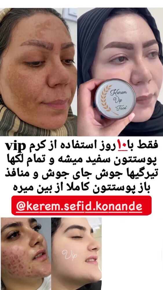  جدید ترین استوری اینستاگرام مائده کریمی