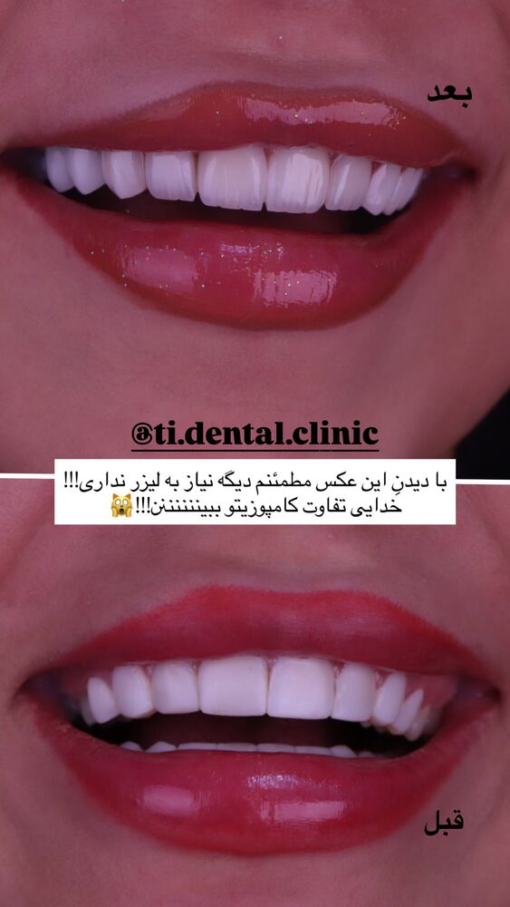  جدید ترین استوری اینستاگرام مائده کریمی