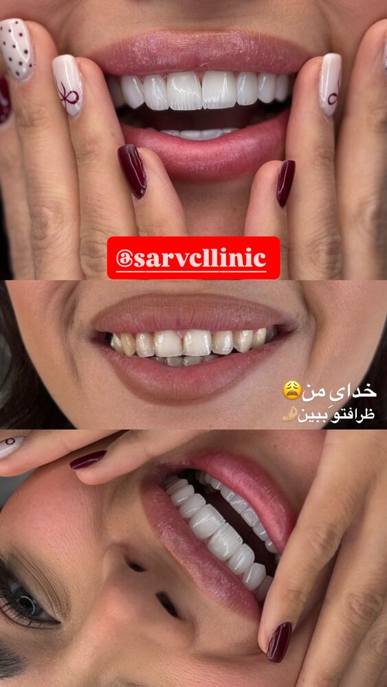  جدید ترین استوری اینستاگرام مائده کریمی