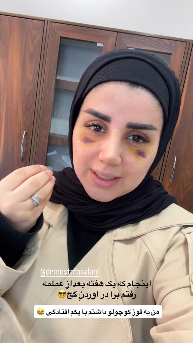  جدید ترین استوری اینستاگرام مائده مرادی