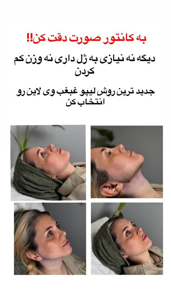  جدید ترین استوری اینستاگرام مائده مرادی