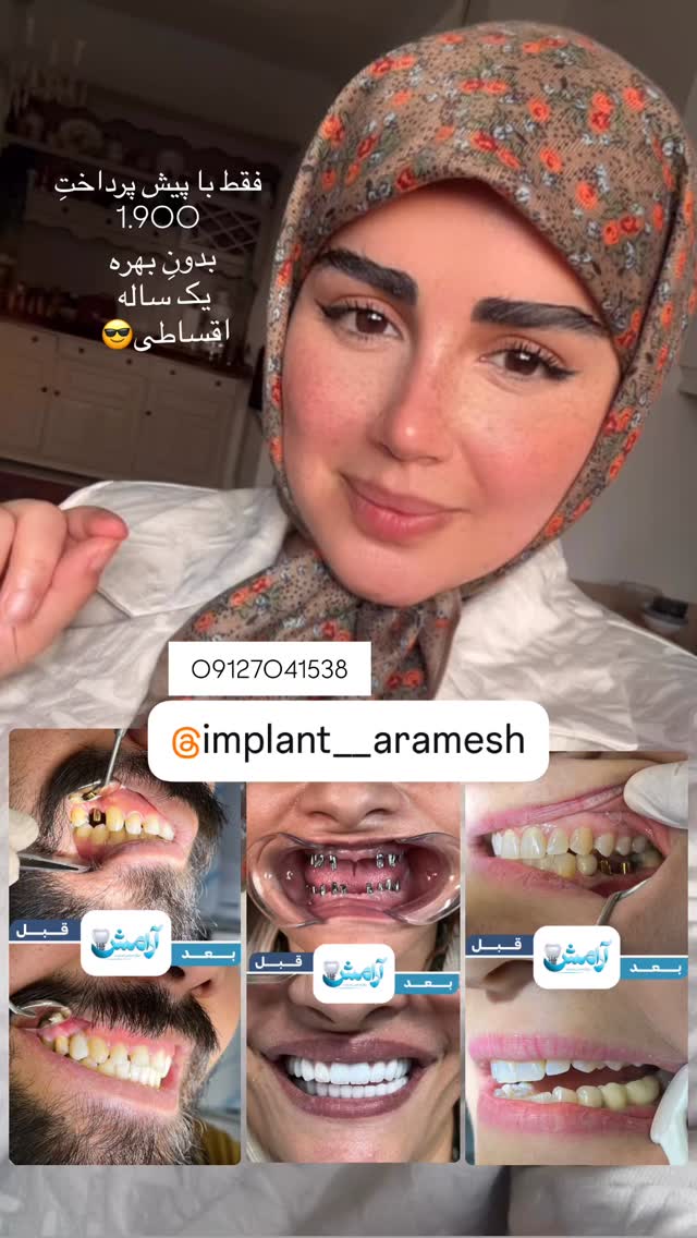 جدید ترین استوری اینستاگرام مائده مرادی