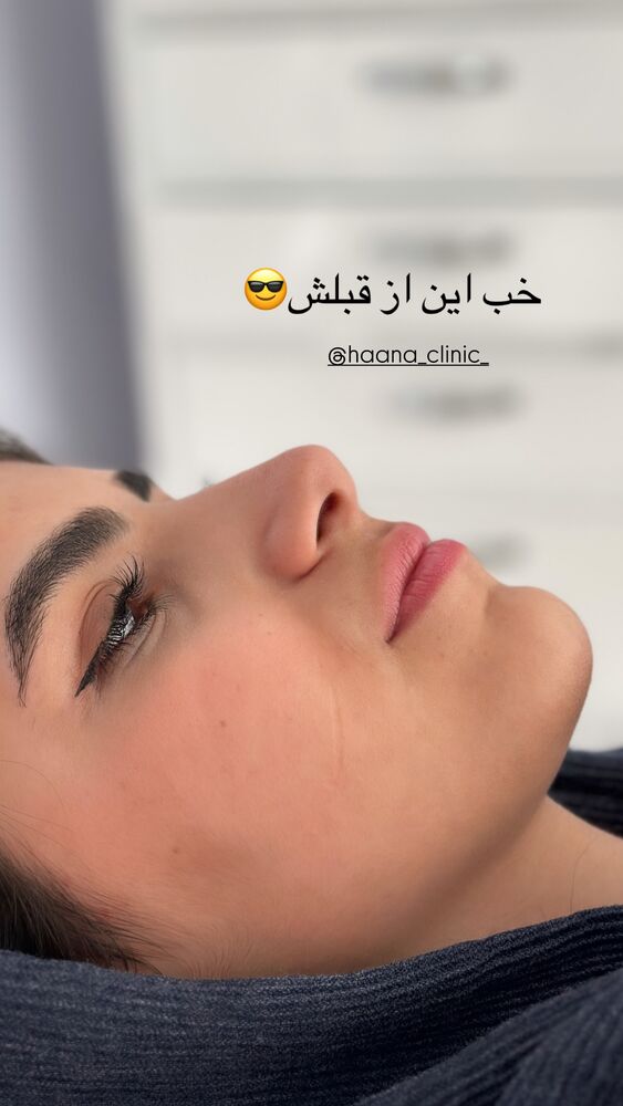  جدید ترین استوری اینستاگرام مائده مرادی