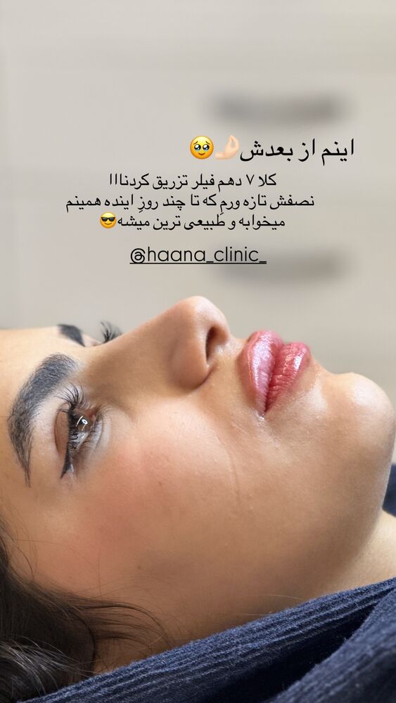  جدید ترین استوری اینستاگرام مائده مرادی