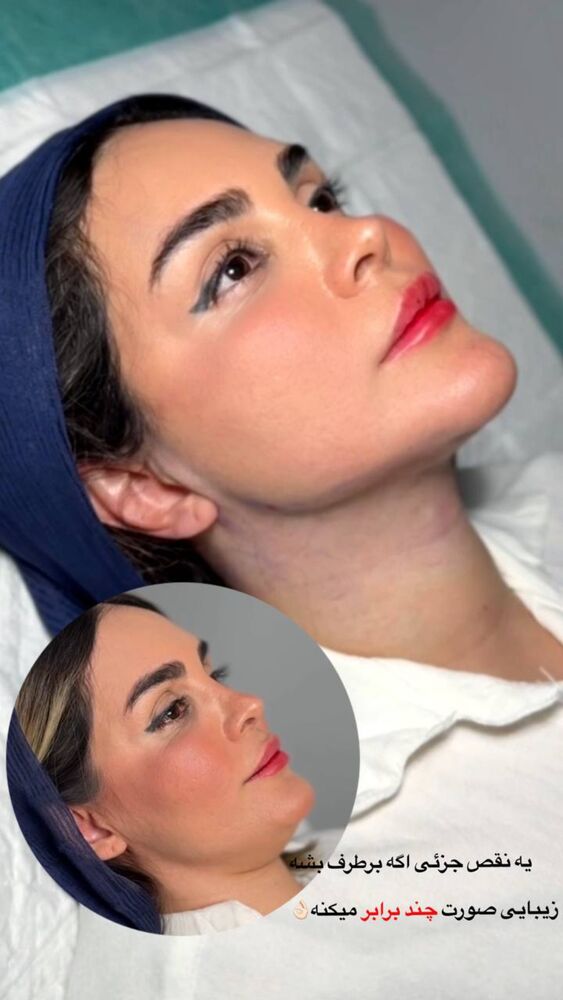  جدید ترین استوری اینستاگرام مائده مرادی
