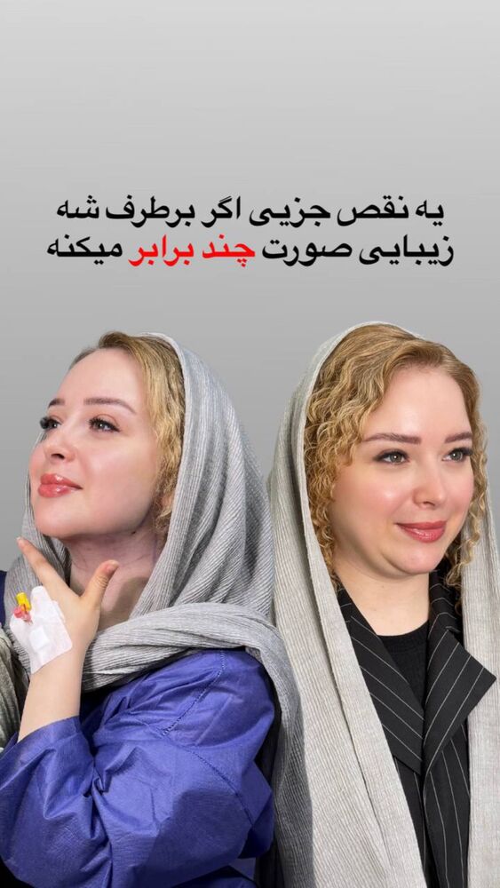  جدید ترین استوری اینستاگرام مائده مرادی