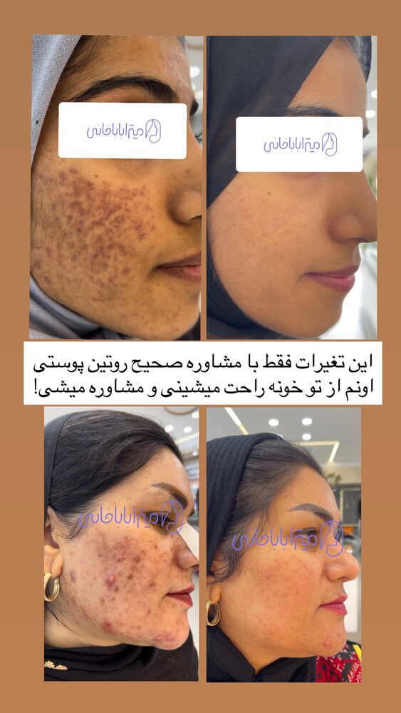  جدید ترین استوری اینستاگرام مائده مرادی