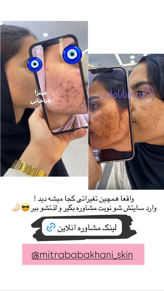  جدید ترین استوری اینستاگرام مائده مرادی