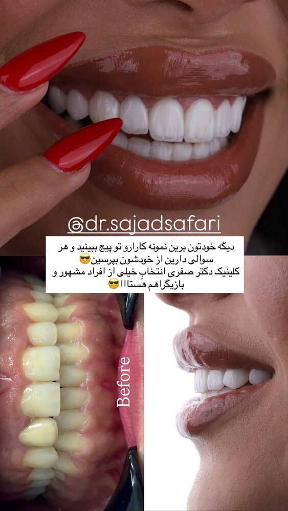 جدید ترین استوری اینستاگرام مائده مرادی