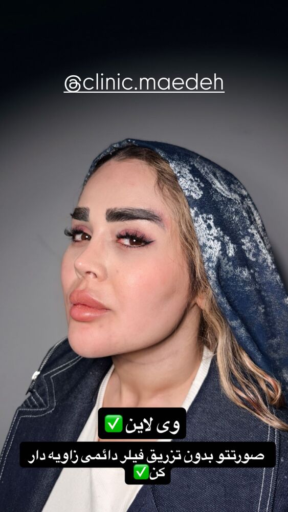  جدید ترین استوری اینستاگرام مائده مرادی