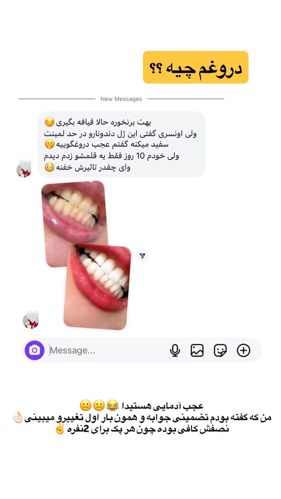  جدید ترین استوری اینستاگرام مائده مرادی