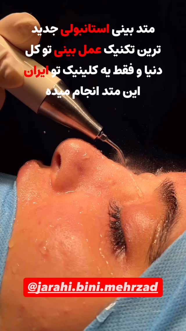  جدید ترین استوری اینستاگرام سید مهدی حسینیان