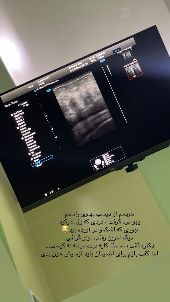  جدید ترین استوری اینستاگرام مهدیه صدیقی