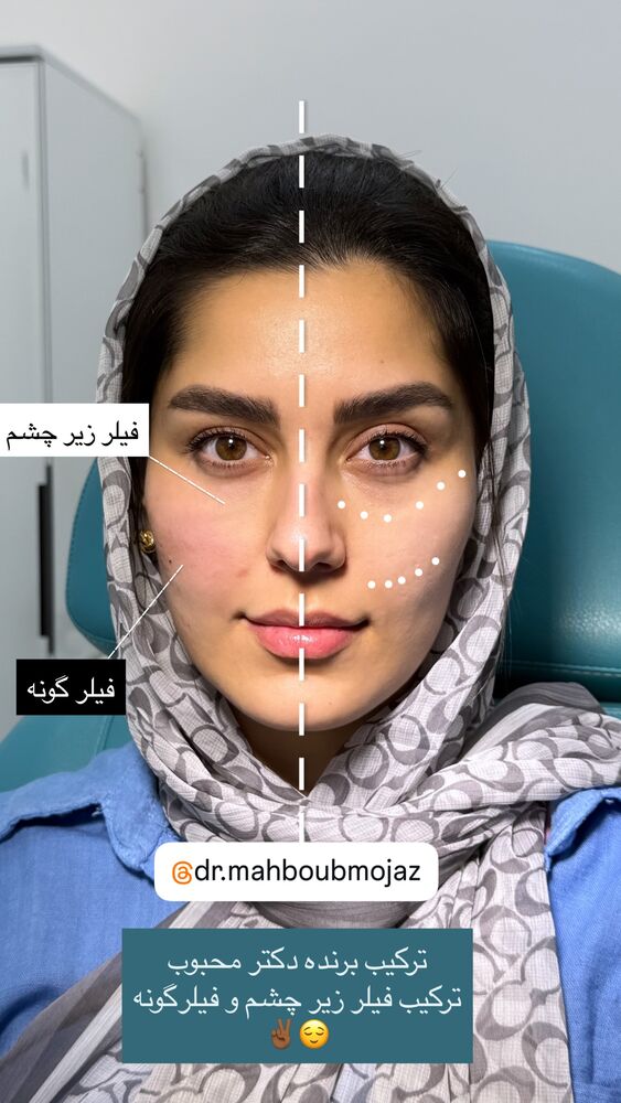  جدید ترین استوری اینستاگرام مهدیس مباشرتی