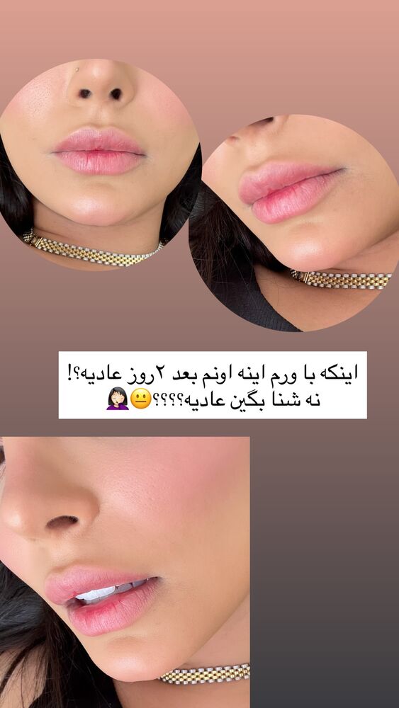  جدید ترین استوری اینستاگرام مهدیس مباشرتی