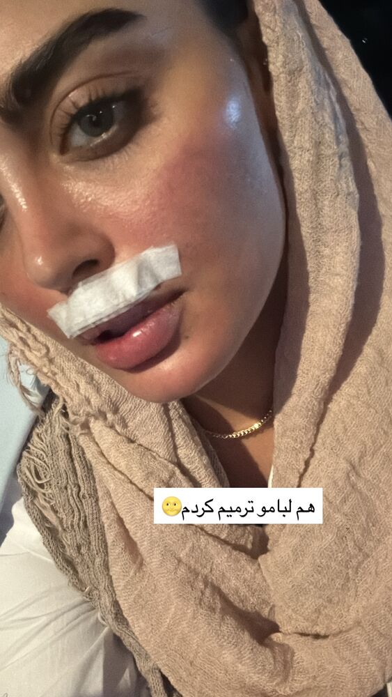  جدید ترین استوری اینستاگرام مهدیس مباشرتی