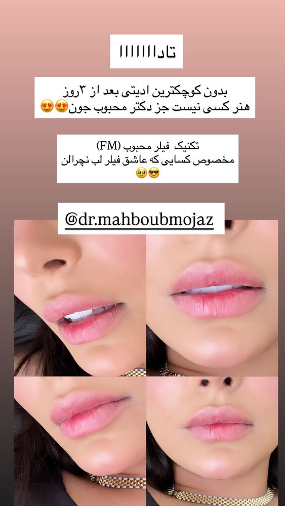  جدید ترین استوری اینستاگرام مهدیس مباشرتی
