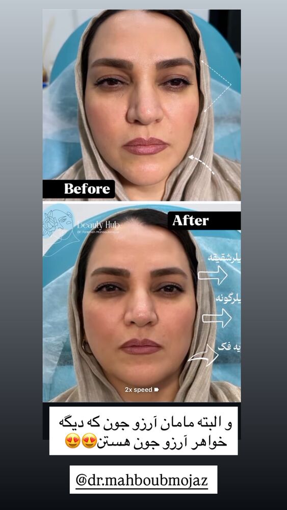  جدید ترین استوری اینستاگرام مهدیس مباشرتی